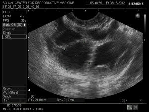Ultrasound-1b-300x225